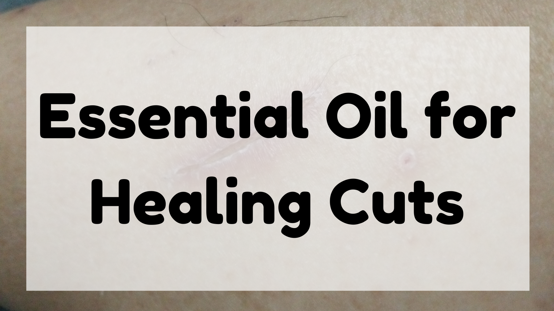 Essential Oil for Healing Cuts featured image