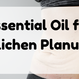 Essential Oil for Lichen Planus featured image