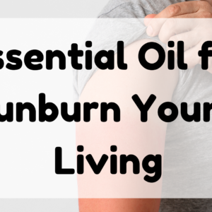 Essential Oil for Sunburn Young Living featured image