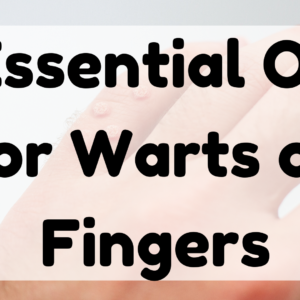 Essential Oil for Warts on Fingers featured image