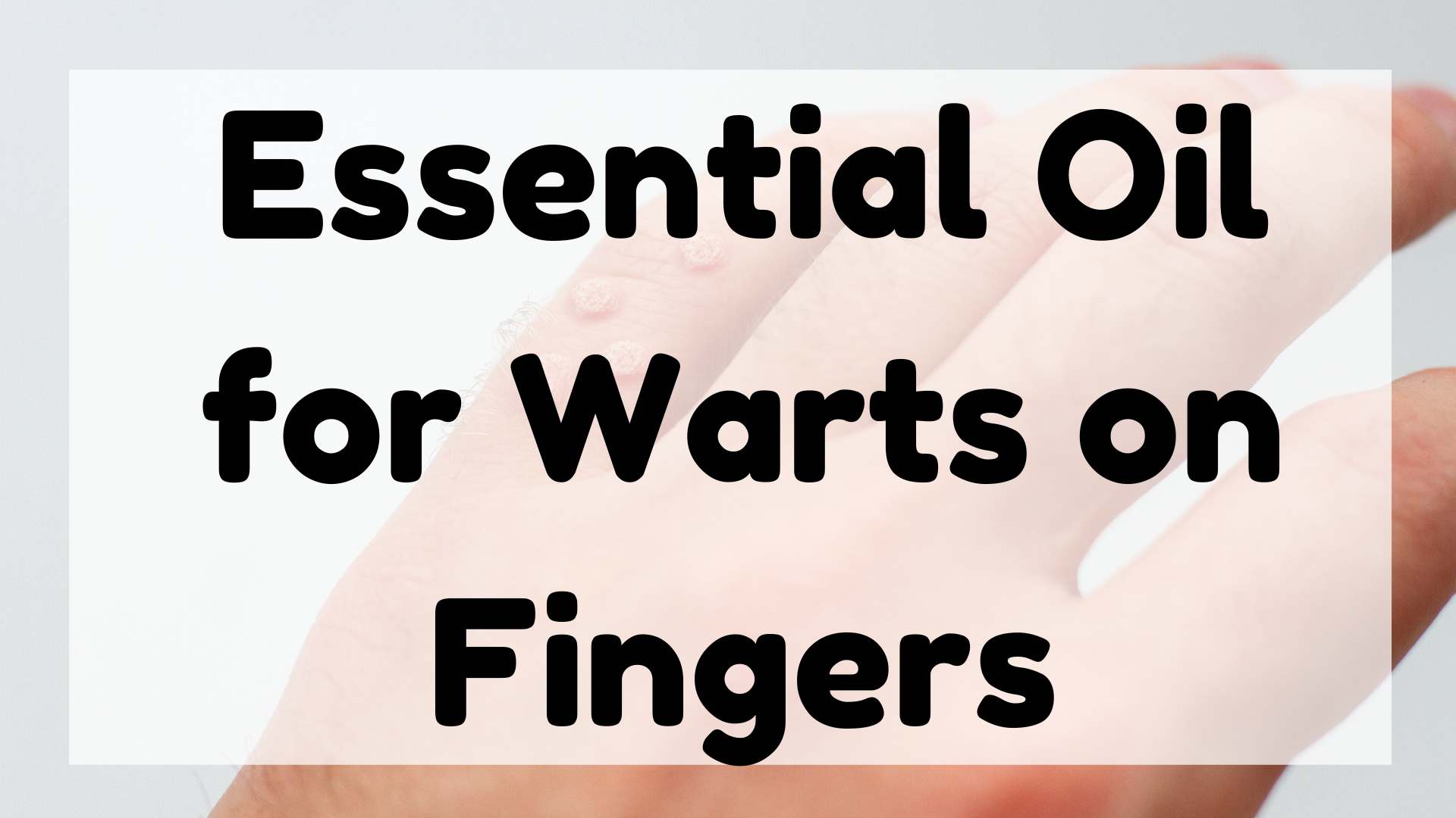 Essential Oil for Warts on Fingers featured image