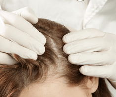 checking for flaky scalp on woman