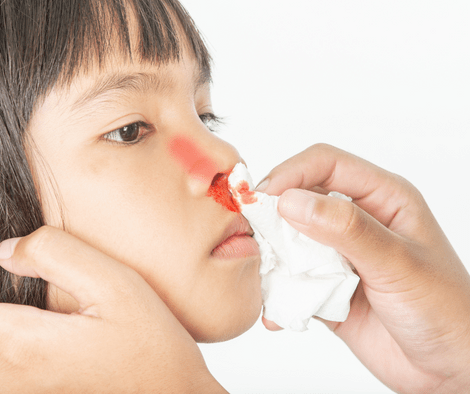child having nose bleed