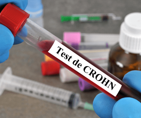 testing for crohn's disease