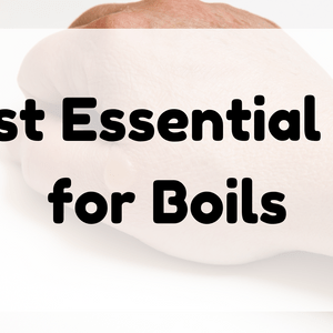 Best Essential Oil for Boils featured image