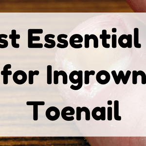 Best Essential Oil for Ingrown Toenail featured image