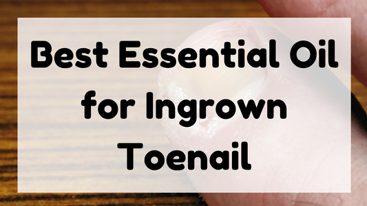 Best Essential Oil for Ingrown Toenail featured image