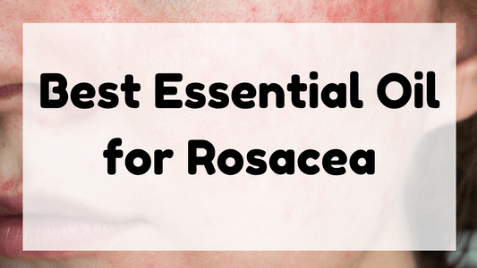 Best Essential Oil for Rosacea featured image