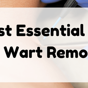 Best Essential Oil for Wart Removal featured image
