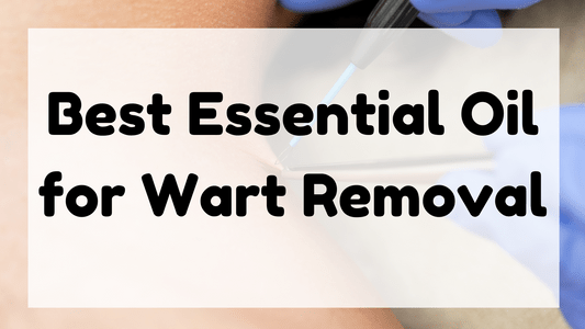 Best Essential Oil for Wart Removal featured image