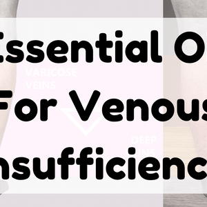 Essential Oil For Venous Insufficiency featured image
