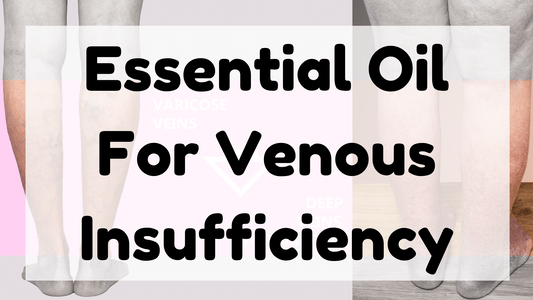 Essential Oil For Venous Insufficiency featured image