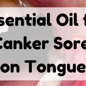 Essential Oil for Canker Sore on Tongue featured image