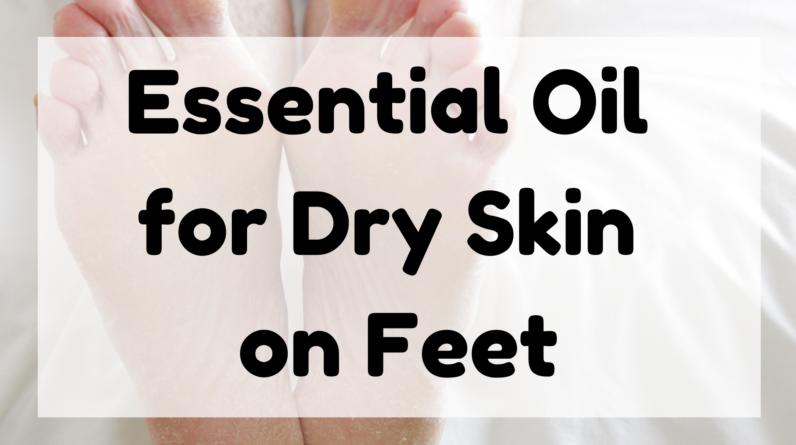 Essential Oil for Dry Skin on Feet featured image