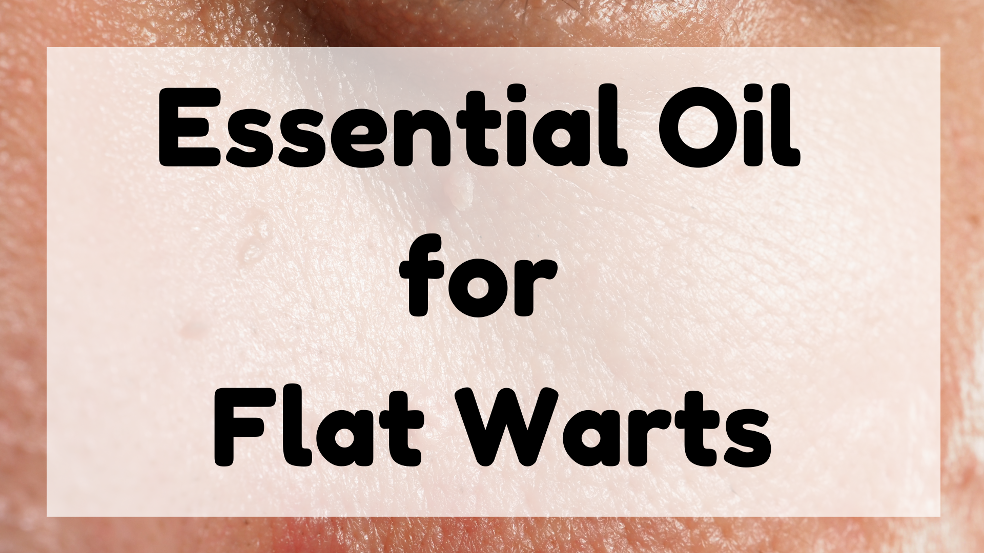 Essential Oil for Flat Warts featured image