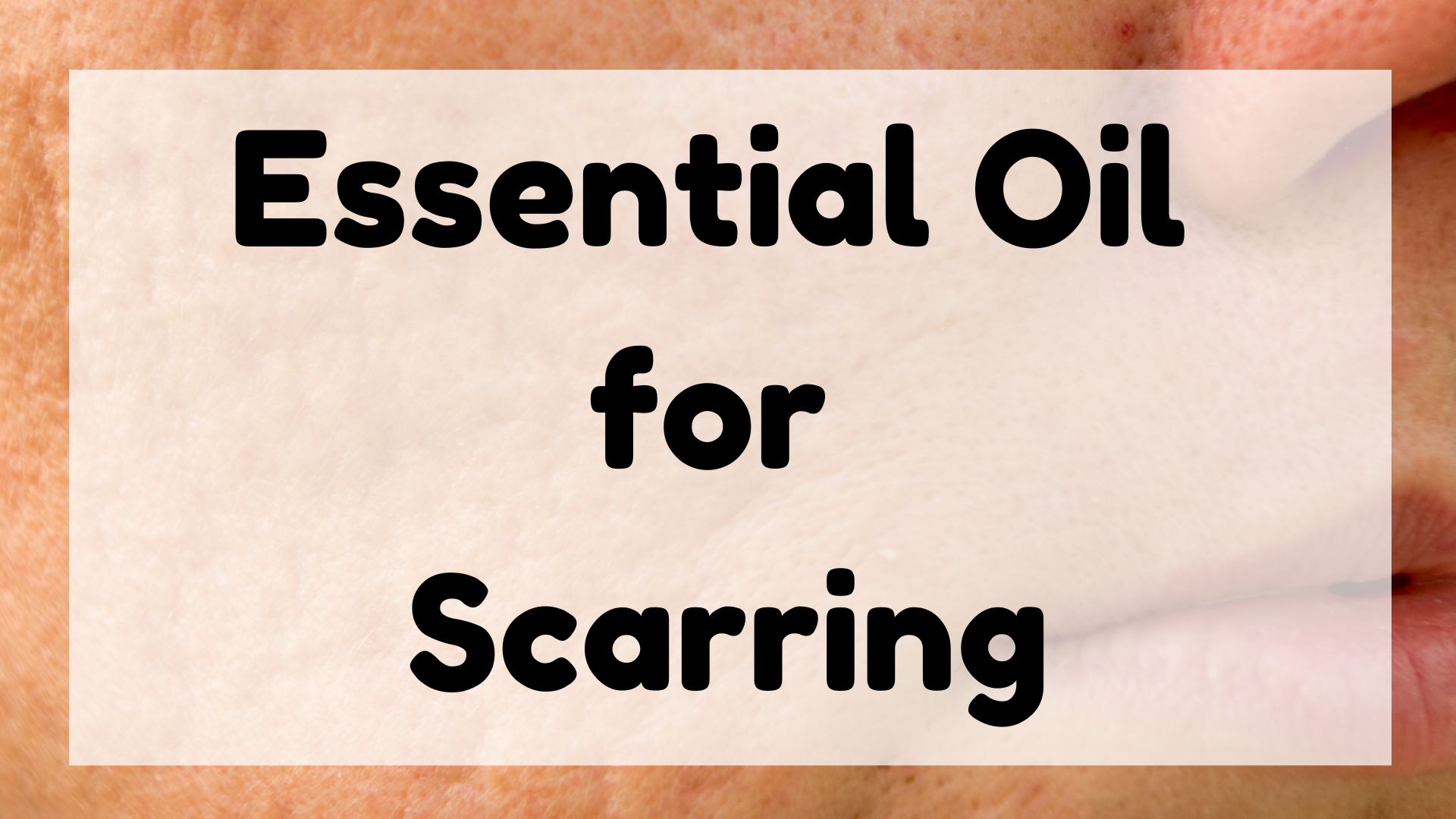 Essential Oil for Scarring featured image