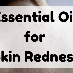 Essential Oil for Skin Redness featured image
