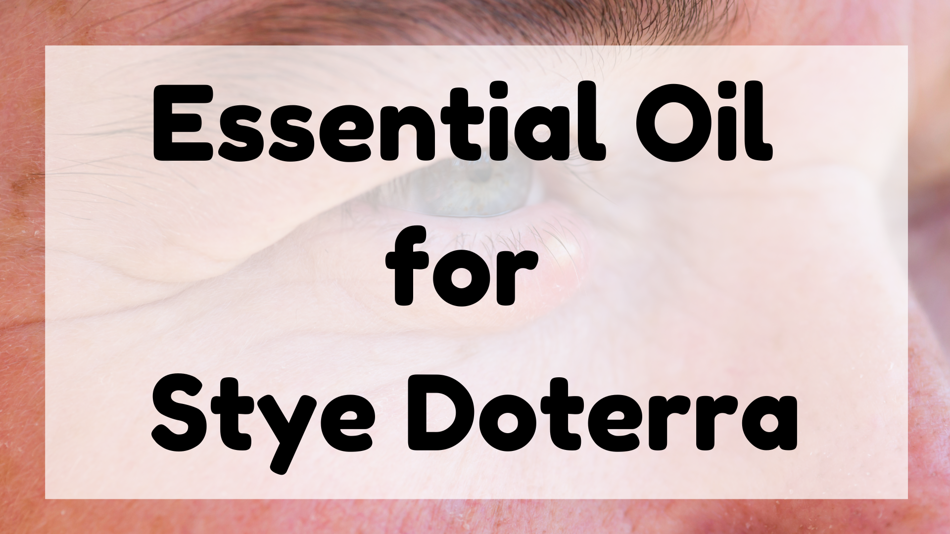 Essential Oil for Stye Doterra featured image