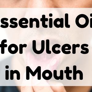 Essential Oil for Ulcers in Mouth featured image