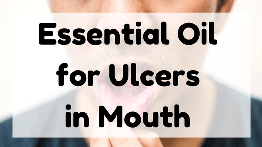 Essential Oil for Ulcers in Mouth featured image