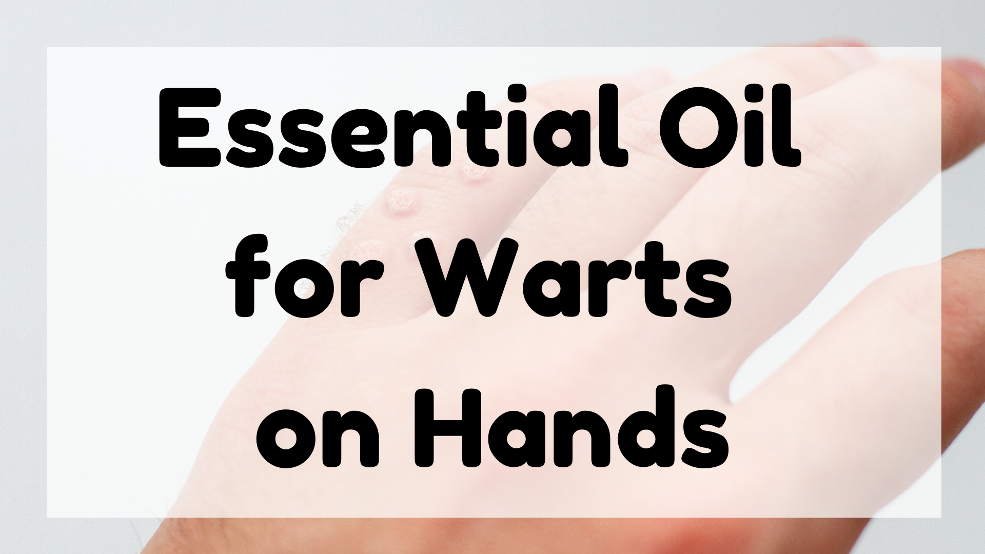 Essential Oil for Warts on Hands featured image