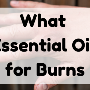 What Essential Oil for Burns featured image