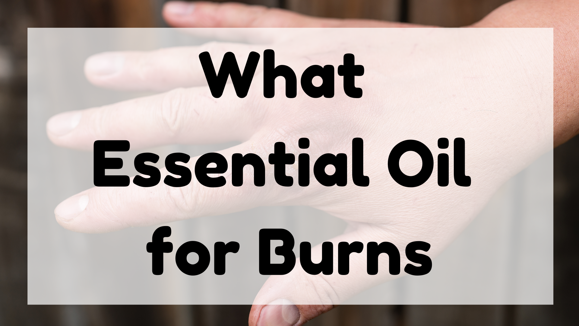 What Essential Oil for Burns featured image