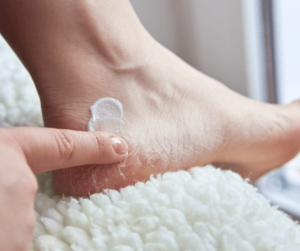 applying cream on dry skin on feet